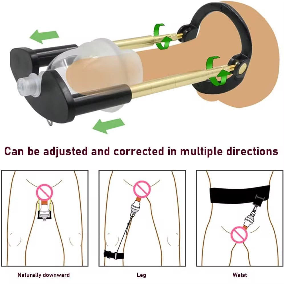 Agrandisseur pénien orthopédique