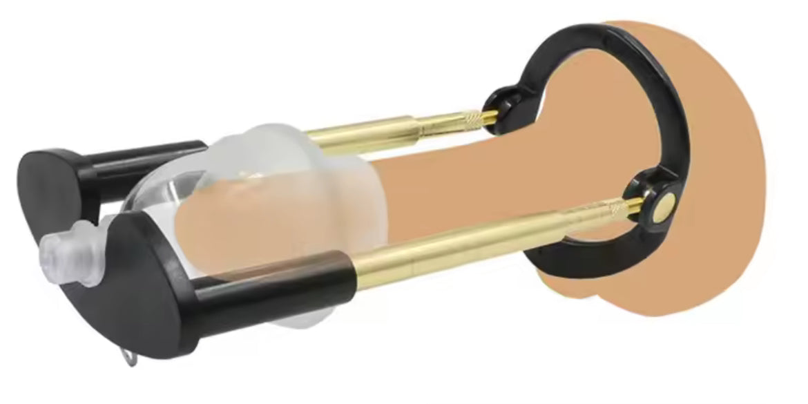 Agrandisseur orthopédique Nickson